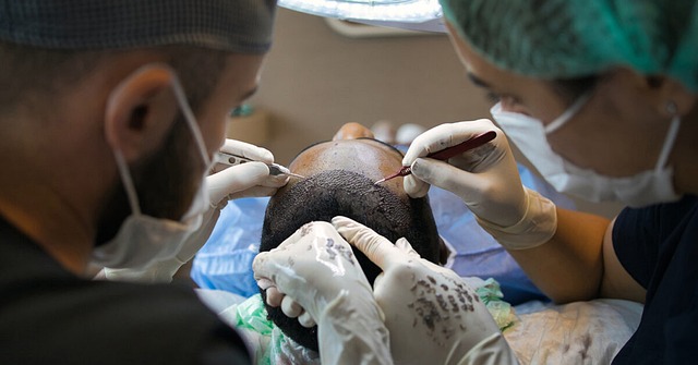 Hvad er prisen på en hårtransplantation? Få svar på dine spørgsmål her